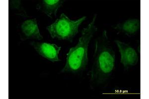 Immunofluorescence of monoclonal antibody to PPP3R1 on HeLa cell. (PPP3R1 antibody  (AA 1-170))