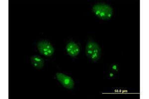 Immunofluorescence of purified MaxPab antibody to ABT1 on HeLa cell. (Activator of Basal Transcription 1 antibody  (AA 1-272))