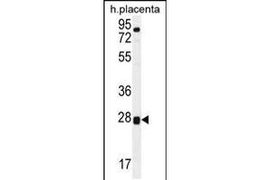 Western blot analysis in human placenta tissue lysates (35ug/lane). (TOR2A antibody  (AA 194-221))