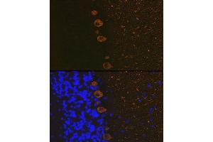 Immunofluorescence (IF) image for anti-Inositol 1,4,5-Trisphosphate Receptor, Type 1 (ITPR1) antibody (ABIN1679064)