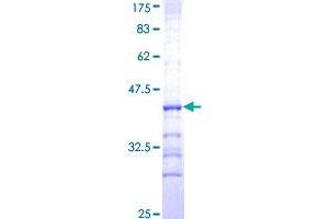 Metabotropic Glutamate Receptor 5 Protein (AA 419-518) (GST tag)