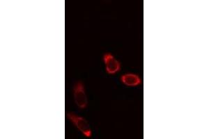 ABIN6275977 staining Hela cells by IF/ICC. (CCZ1B antibody)