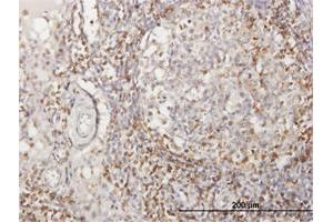 Immunohistochemistry (Formalin-fixed Paraffin-embedded Sections) (IHC (fp)) image for anti-CD2 (CD2) (AA 1-351) antibody (ABIN514128)