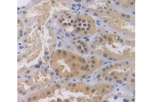 Used in DAB staining on fromalin fixed paraffin- embedded Kidney tissue (ZNF10 antibody  (AA 1-244))