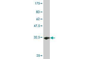 Solute Carrier Family 35 (UDP-GlcNAc/UDP-Glucose Transporter), Member D2 (SLC35D2) (AA 74-131) antibody