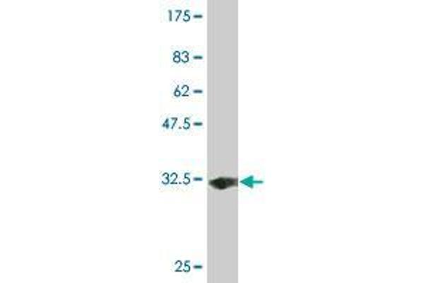 Solute Carrier Family 35 (UDP-GlcNAc/UDP-Glucose Transporter), Member D2 (SLC35D2) (AA 74-131) antibody