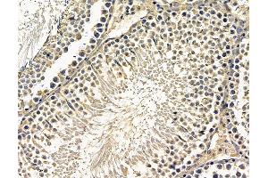 ABIN7096656 and ABIN7100721 at 1/100 staining rat testis tissue by IHC-P.