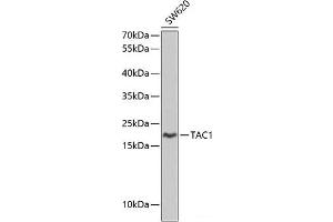 Western blot analysis of extracts of SW620 cells using TAC1 Polyclonal Antibody at dilution of 1:1000.