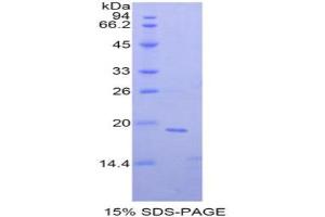 SDS-PAGE analysis of Mouse NME4 Protein. (Non Metastatic Cells 4, Protein NM23A Expressed In Protein)