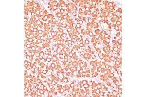 Immunohistochemistry of paraffin-embedded rat ovary using MEK3 antibody (ABIN6130544, ABIN6143484, ABIN6143485 and ABIN6223650) at dilution of 1:100 (40x lens). (MAP2K3 antibody  (AA 1-170))