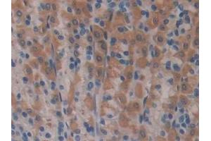 Detection of NOS2 in Rat Stomach Tissue using Polyclonal Antibody to Nitric Oxide Synthase 2, Inducible (NOS2)