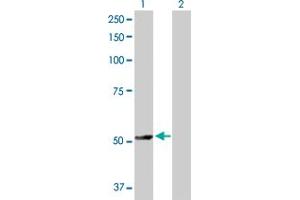 Western Blot analysis of TRAF4 expression in transfected 293T cell line by TRAF4 MaxPab polyclonal antibody. (TRAF4 antibody  (AA 1-470))