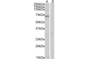ABIN185248 (0. (FOXO3 antibody  (C-Term))