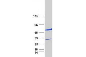 PDCD2L Protein (Myc-DYKDDDDK Tag)