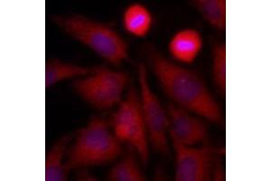 Immunofluorescenitrocellulosee of human HeLa cells stained with Hoechst 3342 (Blue) for nucleus staining and monoclonal anti-human GAPDH antibody (1:500) with Texas Red (Red).