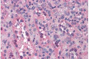 Human Spleen: Formalin-Fixed, Paraffin-Embedded (FFPE) (BUB1B antibody  (AA 274-525))