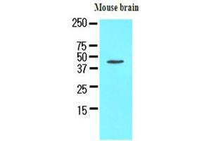 The extracts of mouse brain (50ug) were resolved by SDS-PAGE, transferred to NC membrane and probed with anti-human Homer1 (1:1000). (HOMER1 antibody)