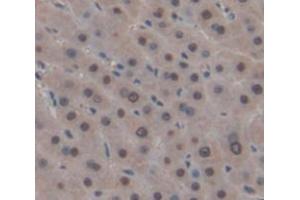 Figure. (MX2 antibody  (AA 1-300))