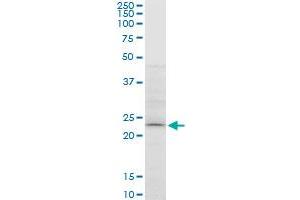 ATG5 monoclonal antibody (M05), clone 1E7. (ATG5 antibody  (AA 176-275))