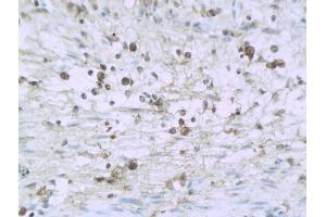 Formalin-fixed and paraffin embedded mouse enterocolitis labeled with Anti-IL-32/NK4 Polyclonal Antibody, Unconjugated (ABIN748298) followed by conjugation to the secondary antibody and DAB staining