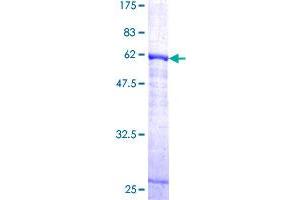 Cathepsin K Protein (CTSK) (AA 15-329) (GST tag)