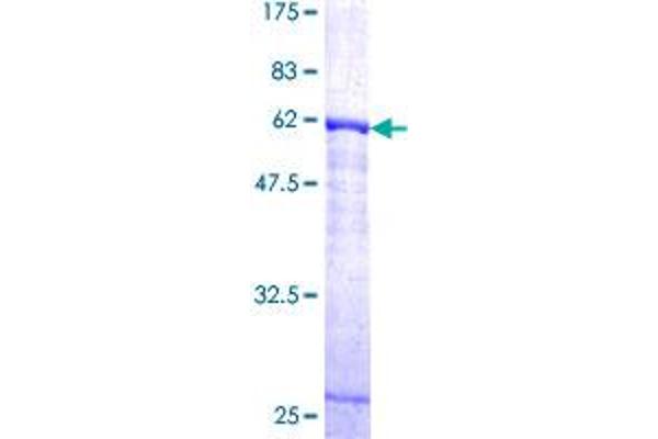 Cathepsin K Protein (CTSK) (AA 15-329) (GST tag)