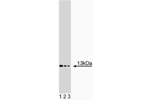 Western blot analysis of Acid Ceramidase on NHEK lysate.