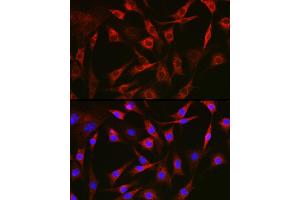 Immunofluorescence analysis of NIH-3T3 cells using FAK Rabbit pAb (ABIN6131638, ABIN6146424, ABIN6146426 and ABIN6215254) at dilution of 1:100 (40x lens). (FAK antibody  (AA 425-660))