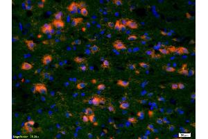 Formalin-fixed and paraffin-embedded rat brain labeled with Anti-CCDC12 Polyclonal Antibody, Unconjugated (ABIN872486) 1:200, overnight at 4°C, The secondary antibody was Goat Anti-Rabbit IgG, Cy3 conjugated used at 1:200 dilution for 40 minutes at 37°C. (CCDC12 antibody  (AA 19-120))