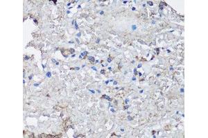 Immunohistochemistry of paraffin-embedded Human lung using NLRC4 Polyclonal Antibody at dilution of 1:100 (40x lens). (NLRC4 antibody)