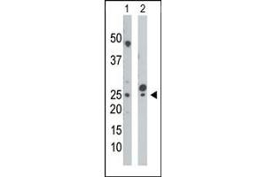 The anti-UCK Pab (ABIN392730 and ABIN2842193) is used in Western blot to detect UCK in mouse cerebellum tissue lysate (Lane 1) and HepG2 cell lysate (Lane 2). (UCK antibody  (N-Term))