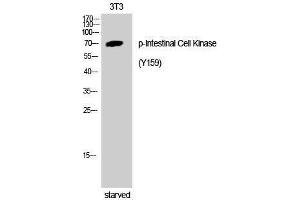 Western Blotting (WB) image for anti-Intestinal Cell (MAK-Like) Kinase (ICK) (pTyr159) antibody (ABIN3182316) (ICK antibody  (pTyr159))