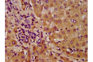 IHC image of ABIN7143530 diluted at 1:600 and staining in paraffin-embedded human liver tissue performed on a Leica BondTM system. (NUDT5 antibody  (AA 34-166))