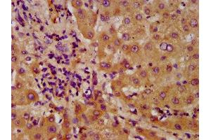Immunohistochemistry (IHC) image for anti-Nudix (Nucleoside Diphosphate Linked Moiety X)-Type Motif 5 (NUDT5) (AA 34-166) antibody (ABIN7143530)