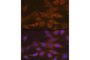 Immunofluorescence analysis of C6 cells using IMPDH2 Rabbit mAb  at dilution of 1:100 (40x lens). (IMPDH2 antibody)