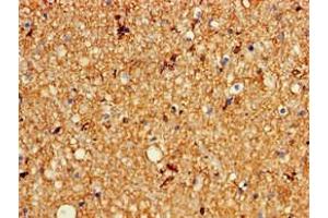 Immunohistochemistry of paraffin-embedded human brain tissue using ABIN7163965 at dilution of 1:100 (KCNC1 antibody  (AA 1-190))