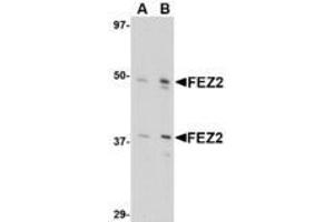 Image no. 1 for anti-Fasciculation and Elongation Protein zeta 2 (Zygin II) (FEZ2) (Internal Region) antibody (ABIN1493789) (FEZ2 antibody  (Internal Region))