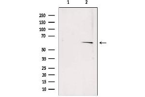 Western blot analysis of extracts from rat muscle, using SQLE antibody. (SQLE antibody  (C-Term))