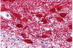 Human Brain, Cortex (formalin-fixed, paraffin-embedded) stained with MAP2 antibody ABIN239820 at 10 ug/ml followed by biotinylated anti-mouse IgG secondary antibody ABIN481714, alkaline phosphatase-streptavidin and chromogen. (MAP2 antibody  (AA 1375-1395))