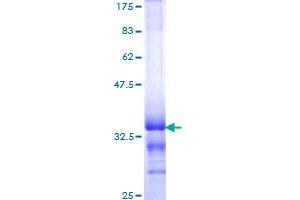 Topoisomerase I Protein (AA 692-765) (GST tag)