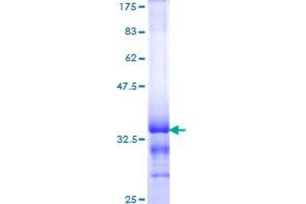 Topoisomerase I Protein (AA 692-765) (GST tag)