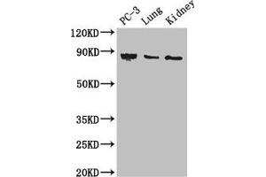 Western Blot Positive WB detected in: PC-3 whole cell lysate, Mouse lung tissue, Mouse kidney tissue All lanes: CARS antibody at 3 μg/mL Secondary Goat polyclonal to rabbit IgG at 1/50000 dilution Predicted band size: 86, 83, 95 kDa Observed band size: 86 kDa (CARS antibody  (AA 201-500))