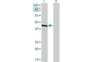 Western Blot analysis of TRIM63 expression in transfected 293T cell line by TRIM63 monoclonal antibody (M01), clone 6G6. (TRIM63 antibody  (AA 254-352))