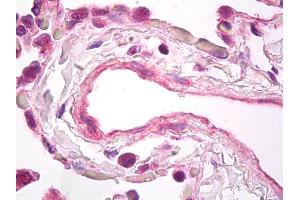 Anti-VEGF antibody IHC of human lung, vascular endothelium. (VEGFA antibody)