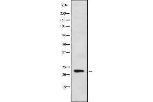 Western blot analysis of CYB561D1 using HeLa whole cell lysates (CYB561D1 antibody  (C-Term))