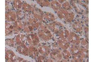 Immunohistochemistry (IHC) image for anti-Ectonucleotide Pyrophosphatase/phosphodiesterase 2 (ENPP2) (AA 637-905) antibody (ABIN7427858)