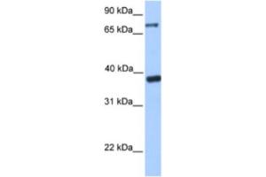 Western Blotting (WB) image for anti-Death Inducer-Obliterator 1 (DIDO1) antibody (ABIN2461923) (DIDO1 antibody)