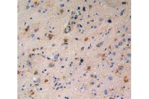 Used in DAB staining on fromalin fixed paraffin- embedded glioma tissue (RENBP antibody  (AA 1-254))