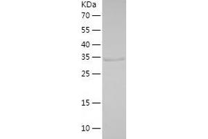 Western Blotting (WB) image for Chondroadherin (CHAD) (AA 23-359) protein (His tag) (ABIN7284370) (CHAD Protein (AA 23-359) (His tag))