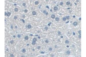 Detection of NLRP3 in Mouse Liver Tissue using Polyclonal Antibody to NLR Family, Pyrin Domain Containing Protein 3 (NLRP3)